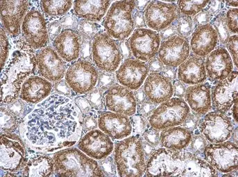 Anti-Pumilio 2 antibody [N1N2], N-term used in IHC (Paraffin sections) (IHC-P). GTX107995
