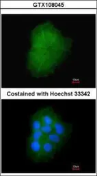 Anti-Transmembrane protein 147 antibody [N1C1] used in Immunocytochemistry/ Immunofluorescence (ICC/IF). GTX108045