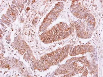 Anti-VPS35 antibody [C3], C-term used in IHC (Paraffin sections) (IHC-P). GTX108058