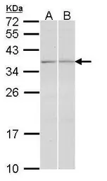 Anti-TGF beta induced factor 2 antibody used in Western Blot (WB). GTX108069