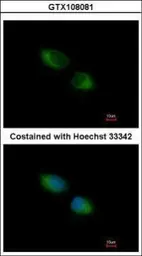 Anti-TXNDC1 antibody [C2C3], C-term used in Immunocytochemistry/ Immunofluorescence (ICC/IF). GTX108081