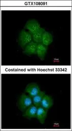 Anti-TAB182 antibody [N1], N-term used in Immunocytochemistry/ Immunofluorescence (ICC/IF). GTX108091