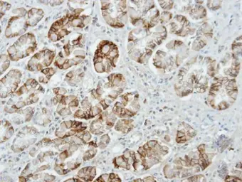 Anti-Munc 13-4 antibody [C3], C-term used in IHC (Paraffin sections) (IHC-P). GTX108105