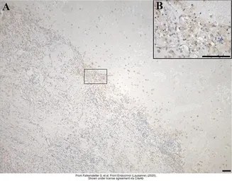 Anti-GALR3 antibody used in IHC (Paraffin sections) (IHC-P). GTX108163