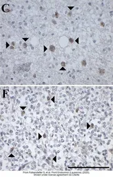 Anti-GALR3 antibody used in IHC (Paraffin sections) (IHC-P). GTX108163