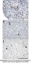 Anti-GALR3 antibody used in IHC (Paraffin sections) (IHC-P). GTX108163
