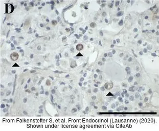 Anti-GALR3 antibody used in IHC (Paraffin sections) (IHC-P). GTX108163