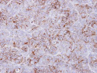 Anti-GALR3 antibody used in IHC (Paraffin sections) (IHC-P). GTX108163
