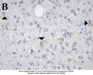 Anti-GALR1 antibody [C2C3], C-term used in IHC (Paraffin sections) (IHC-P). GTX108207