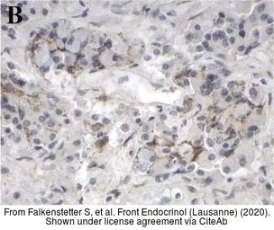 Anti-GALR1 antibody [C2C3], C-term used in IHC (Paraffin sections) (IHC-P). GTX108207
