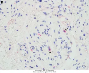 Anti-GALR1 antibody [C2C3], C-term used in IHC (Paraffin sections) (IHC-P). GTX108207