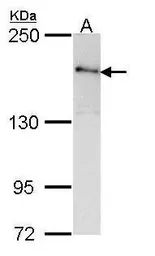 Anti-ROCK2 antibody [N3C1], Internal used in Western Blot (WB). GTX108247
