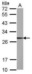 Anti-ARL1 antibody used in Western Blot (WB). GTX108258