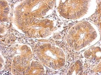 Anti-alpha TTP antibody [C2C3], C-term used in IHC (Paraffin sections) (IHC-P). GTX108286