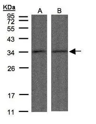Anti-PPP4C antibody [N1], N-term used in Western Blot (WB). GTX108299