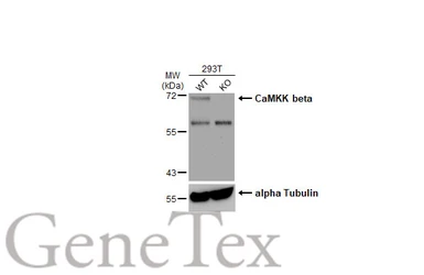 Anti-CaMKK beta antibody used in Western Blot (WB). GTX108305