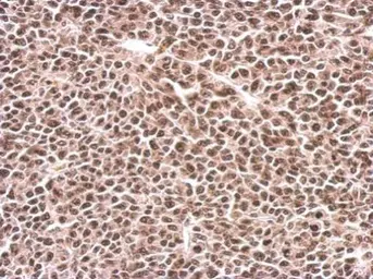 Anti-PFKFB3 antibody [C3], C-term used in IHC (Paraffin sections) (IHC-P). GTX108335