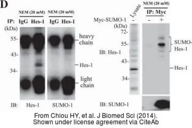 Anti-HES1 antibody [N1], N-term used in Western Blot and Immunoprecipitation (WB IP). GTX108356