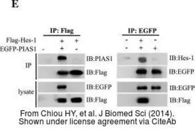 Anti-HES1 antibody [N1], N-term used in Western Blot (WB). GTX108356