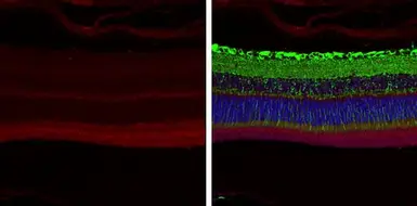 Anti-ABCA4 antibody [C3-2], C-term used in IHC (Paraffin sections) (IHC-P). GTX108371