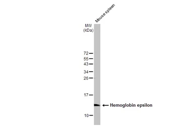 Anti-Hemoglobin epsilon antibody [N1N2], N-term used in Western Blot (WB). GTX108396