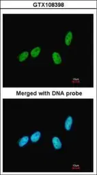 Anti-RED antibody [N1], N-term used in Immunocytochemistry/ Immunofluorescence (ICC/IF). GTX108398