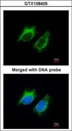 Anti-Inhibin beta A antibody used in Immunocytochemistry/ Immunofluorescence (ICC/IF). GTX108405