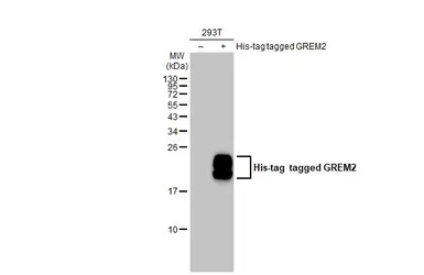 Anti-GREM2 antibody [C1C3] used in Western Blot (WB). GTX108414