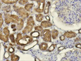 Anti-CXCL14 antibody [N3C3] used in IHC (Paraffin sections) (IHC-P). GTX108431