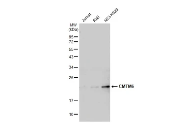 Anti-CMTM6 antibody [C1C3] used in Western Blot (WB). GTX108450