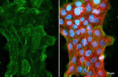 Anti-CMTM6 antibody [C1C3] used in Immunocytochemistry/ Immunofluorescence (ICC/IF). GTX108450