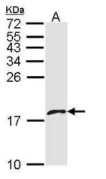 Anti-PF4V1 antibody [N3C3] used in Western Blot (WB). GTX108457
