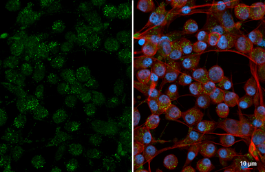 Anti-Syntenin 1 antibody [C2C3], C-term used in Immunocytochemistry/ Immunofluorescence (ICC/IF). GTX108470