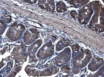 Anti-TRAM1 antibody [C2C3], C-term used in IHC (Paraffin sections) (IHC-P). GTX108535