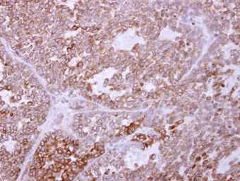Anti-TRAM1 antibody [C2C3], C-term used in IHC (Paraffin sections) (IHC-P). GTX108535