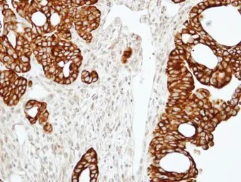 Anti-RAP2C antibody used in IHC (Paraffin sections) (IHC-P). GTX108596