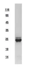 Human N-Ras protein, His tag. GTX108598-pro