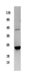 Human SOCS2 protein, His tag. GTX108602-pro
