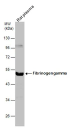 Anti-Fibrinogen gamma antibody used in Western Blot (WB). GTX108640