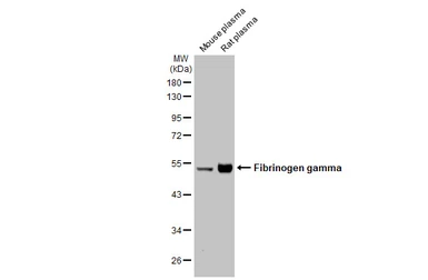 Anti-Fibrinogen gamma antibody used in Western Blot (WB). GTX108640