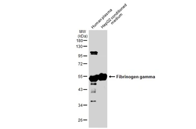 Anti-Fibrinogen gamma antibody used in Western Blot (WB). GTX108640