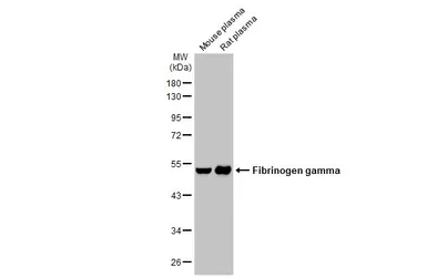Anti-Fibrinogen gamma antibody used in Western Blot (WB). GTX108640
