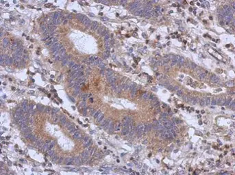 Anti-RFX6 antibody [C2C3], C-term used in IHC (Paraffin sections) (IHC-P). GTX108670