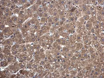 Anti-TrxR1 antibody [N3C2], Internal used in IHC (Paraffin sections) (IHC-P). GTX108727