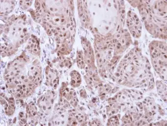 Anti-TrxR1 antibody [N3C2], Internal used in IHC (Paraffin sections) (IHC-P). GTX108727