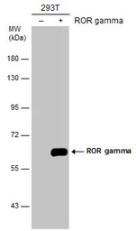 Anti-ROR gamma antibody used in Western Blot (WB). GTX108728