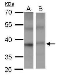 Anti-PSTPIP2 antibody used in Western Blot (WB). GTX108886