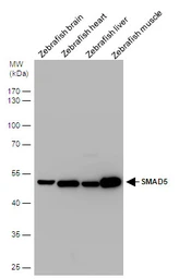 Anti-SMAD5 antibody used in Western Blot (WB). GTX108917