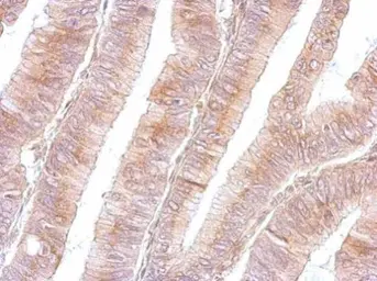 Anti-B3GNT3 antibody used in IHC (Paraffin sections) (IHC-P). GTX108928
