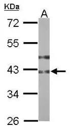 Anti-B3GNT3 antibody used in Western Blot (WB). GTX108928